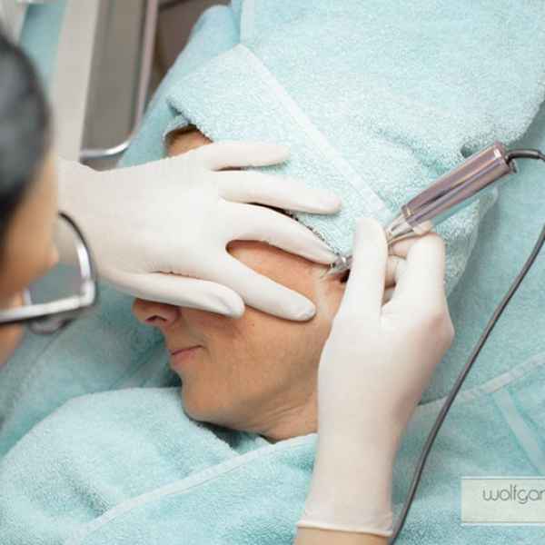 Narben Permanent Make Up